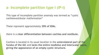 a- Incomplete partition type I (IP-I)
This type of incomplete partition anomaly was termed as “cystic
cochleovestibular malformation”
These represent approximately 20% of IEMs.
there is a clear differentiation between cochlea and vestibule.
Cochlea is located in its usual location in the anterolateral part of the
fundus of the IAC and lacks the entire modiolus and interscalar septa,
giving the appearance of an empty cystic structure.
 