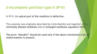 b-Incomplete partition type II (IP-II)
In IP-II, the apical part of the modiolus is defective.
This anomaly was originally described by Carlo Mondini and together with a
minimally dilated vestibule and an enlarged vestibular aqueduct (EVA)
The term “Mondini” should be used only if the above mentioned triad of
malformations is present.
 