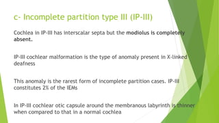 c- Incomplete partition type III (IP-III)
Cochlea in IP-III has interscalar septa but the modiolus is completely
absent.
IP-III cochlear malformation is the type of anomaly present in X-linked
deafness
This anomaly is the rarest form of incomplete partition cases. IP-III
constitutes 2% of the IEMs
In IP-III cochlear otic capsule around the membranous labyrinth is thinner
when compared to that in a normal cochlea
 