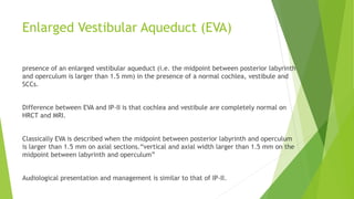 Enlarged Vestibular Aqueduct (EVA)
presence of an enlarged vestibular aqueduct (i.e. the midpoint between posterior labyrinth
and operculum is larger than 1.5 mm) in the presence of a normal cochlea, vestibule and
SCCs.
Difference between EVA and IP-II is that cochlea and vestibule are completely normal on
HRCT and MRI.
Classically EVA is described when the midpoint between posterior labyrinth and operculum
is larger than 1.5 mm on axial sections.“vertical and axial width larger than 1.5 mm on the
midpoint between labyrinth and operculum”
Audiological presentation and management is similar to that of IP-II.
 