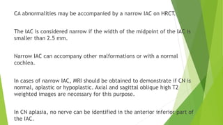 CA abnormalities may be accompanied by a narrow IAC on HRCT.
The IAC is considered narrow if the width of the midpoint of the IAC is
smaller than 2.5 mm.
Narrow IAC can accompany other malformations or with a normal
cochlea.
In cases of narrow IAC, MRI should be obtained to demonstrate if CN is
normal, aplastic or hypoplastic. Axial and sagittal oblique high T2
weighted images are necessary for this purpose.
In CN aplasia, no nerve can be identified in the anterior inferior part of
the IAC.
 