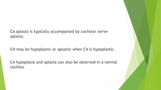 CA aplasia is typically accompanied by cochlear nerve
aplasia.
CN may be hypoplastic or aplastic when CA is hypoplastic.
CA hypoplasia and aplasia can also be observed in a normal
cochlea.
 