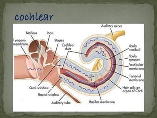 cochlear implant | PDF