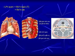 - Liªn quan: + ®o¹n ngùc (T)
+ ®o¹n cæ
§M phÕ qu¶n tr¸i
§M gian sên sau
§M chñ ngùc
§M gian sên sau
(tõ §M díi ®ßn)
 