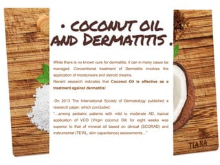 While there is no known cure for dermatitis, it can in many cases be
managed. Conventional treatment of Dermatitis involves the
application of moisturisers and steroid creams.
Recent research indicates that Coconut Oil is effective as a
treatment against dermatitis!
On 2013 The International Society of Dermatology published a
research paper, which concluded:
“…among pediatric patients with mild to moderate AD, topical
application of VCO (Virgin coconut Oil) for eight weeks was
superior to that of mineral oil based on clinical (SCORAD) and
instrumental (TEWL, skin capacitance) assessments…”
 