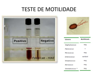 TESTE DE MOTILIDADE
 