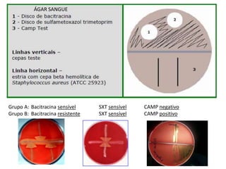 Grupo A: Bacitracina sensível SXT sensível CAMP negativo
Grupo B: Bacitracina resistente SXT sensível CAMP positivo
ÁGAR SANGUE
 