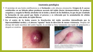 Anatomía patológica
 El prototipo de una lesión estafilocócica es el forúnculo u otro absceso circunscrito. Grupos de S. aureus
establecidos en un folículo piloso producen necrosis del tejido (factor dermonecrótico). Se produce
coagulasa y coagula la fibrina alrededor de la lesión y dentro de los linfáticos, lo que da por resultado
la formación de una pared que limita el proceso y es reforzada por la acumulación de células
inflamatorias y, más tarde, de tejido fibroso.
 En el centro de la lesión ocurre la licuefacción del tejido necrótico (intensificada por la
hipersensibilidad tardía) y el absceso “apunta” hacia la dirección de menos resistencia. Después del
drenaje del tejido necrótico del centro líquido, la cavidad se llena lentamente con tejido de granulación y
después se cicatriza.
 
