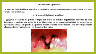 5. Bacteriemia o septicemia
La infección de las heridas traumáticas o quirúrgicas por estreptococos produce bacteriemia, que puede
volverse letal con rapidez.
6. Faringoamigdalitis estreptocócica
S. pyogenes se adhiere al epitelio faríngeo por medio de fimbrias superficiales cubiertas de ácido
lipoteicoico y también por medio de ácido hialurónico en las cepas encapsuladas. Se caracteriza por
rinofaringitis intensa, amigdalitis e hiperemia intensa y edema de las mucosas, con exudado purulento,
adenomegalia cervical dolorosa y por lo general fiebre alta.
 