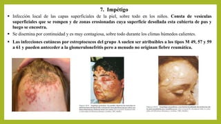 7. Impétigo
 Las infecciones cutáneas por estreptococos del grupo A suelen ser atribuibles a los tipos M 49, 57 y 59
a 61 y pueden anteceder a la glomerulonefritis pero a menudo no originan fiebre reumática.
 Infección local de las capas superficiales de la piel, sobre todo en los niños. Consta de vesículas
superficiales que se rompen y de zonas erosionadas cuya superficie desollada esta cubierta de pus y
luego se encostra.
 Se disemina por continuidad y es muy contagiosa, sobre todo durante los climas húmedos calientes.
 