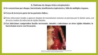 8. Síndrome de choque tóxico estreptocócico
 Se caracterizan por choque, bacteriemia, insuficiencia respiratoria y falla de múltiples órganos.
 Cerca de la tercera parte de los pacientes fallece.
 Estas infecciones tienden a aparecer después de traumatismos menores en personas por lo demás sanas, con
diversos cuadros de infección de tejidos blandos.
 Las infecciones comprenden fascitis necrosante, miositis e infecciones en otros tejidos blandos; la
bacteriemia ocurre con frecuencia.
 