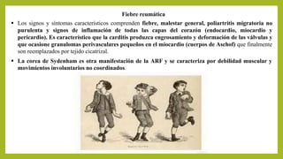  Los signos y síntomas característicos comprenden fiebre, malestar general, poliartritis migratoria no
purulenta y signos de inflamación de todas las capas del corazón (endocardio, miocardio y
pericardio). Es característico que la carditis produzca engrosamiento y deformación de las válvulas y
que ocasione granulomas perivasculares pequeños en el miocardio (cuerpos de Aschof) que finalmente
son reemplazados por tejido cicatrizal.
Fiebre reumática
 La corea de Sydenham es otra manifestación de la ARF y se caracteriza por debilidad muscular y
movimientos involuntarios no coordinados.
 