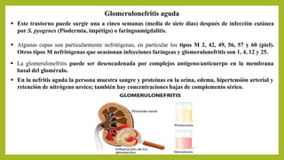  Este trastorno puede surgir una a cinco semanas (media de siete días) después de infección cutánea
por S. pyogenes (Piodermia, impétigo) o faringoamigdalitis.
 Algunas cepas son particularmente nefritógenas, en particular los tipos M 2, 42, 49, 56, 57 y 60 (piel).
Otros tipos M nefritógenas que ocasionan infecciones faríngeas y glomerulonefritis son 1, 4, 12 y 25.
Glomerulonefritis aguda
 La glomerulonefritis puede ser desencadenada por complejos antígeno/anticuerpo en la membrana
basal del glomérulo.
 En la nefritis aguda la persona muestra sangre y proteínas en la orina, edema, hipertensión arterial y
retención de nitrógeno ureico; también hay concentraciones bajas de complemento sérico.
 
