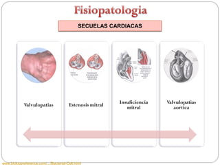 SECUELAS CARDIACAS




                                                           Insuficiencia   Valvulopatias
             Valvulopatias              Estenosis mitral
                                                              mitral          aortica




www.biologyreference.com/.../Bacterial-Cell.html
 