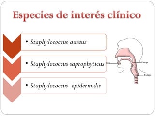 • Staphylococcus aureus

• Staphylococcus saprophyticus

• Staphylococcus epidermidis
 