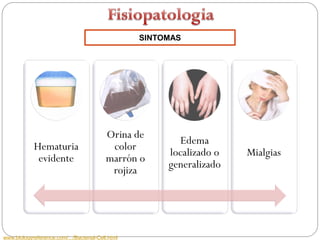 SINTOMAS




                                           Orina de
                                                           Edema
            Hematuria                       color
                                                        localizado o   Mialgias
             evidente                      marrón o
                                                        generalizado
                                            rojiza




www.biologyreference.com/.../Bacterial-Cell.html
 