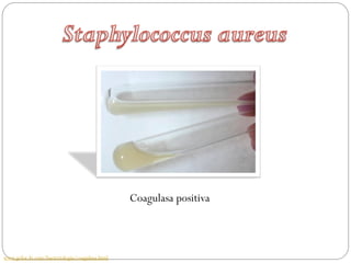 Coagulasa positiva



www.gefor.4t.com/bacteriologia/coagulasa.html
 
