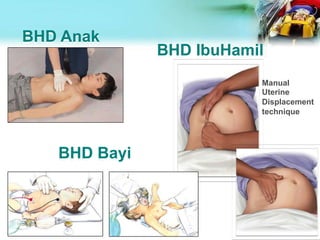 BHD Anak
Manual
Uterine
Displacement
technique
BHD Bayi
BHD IbuHamil
 