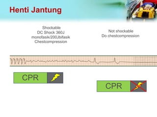 Henti Jantung
Not shockable
Do chestcompression
Shockable
DC Shock 360J
monofasik/200Jbifasik
Chestcompression
CPR
CPR
 