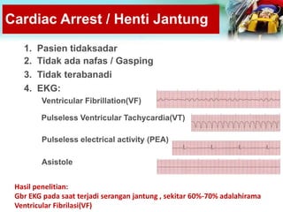 Cardiac Arrest / Henti Jantung
1. Pasien tidaksadar
2. Tidak ada nafas / Gasping
3. Tidak terabanadi
4. EKG:
Ventricular Fibrillation(VF)
Pulseless Ventricular Tachycardia(VT)
Pulseless electrical activity (PEA)
Asistole
Hasil penelitian:
Gbr EKG pada saat terjadi serangan jantung , sekitar 60%-70% adalahirama
Ventricular Fibrilasi(VF)
 