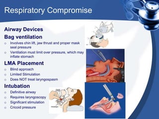 Respiratory Compromise
Airway Devices
Bag ventilation
o Involves chin lift, jaw thrust and proper mask
seal pressure
o Ventilation must limit over pressure, which may
inflate stomach
LMA Placement
o Blind approach
o Limited Stimulation
o Does NOT treat laryngospasm
Intubation
o Definitive airway
o Requires laryngoscopy
o Significant stimulation
o Cricoid pressure
 