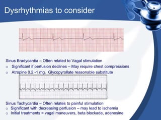Dysrhythmias to consider
Sinus Bradycardia – Often related to Vagal stimulation
o Significant if perfusion declines – May require chest compressions
o Atropine 0.2 -1 mg. Glycopyrollate reasonable substitute
Sinus Tachycardia – Often relates to painful stimulation
o Significant with decreasing perfusion – may lead to ischemia
o Initial treatments = vagal maneuvers, beta blockade, adenosine
 