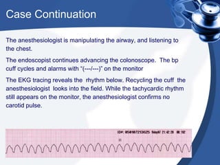 Case Continuation
The anesthesiologist is manipulating the airway, and listening to
the chest.
The endoscopist continues advancing the colonoscope. The bp
cuff cycles and alarms with “(---/---)” on the monitor
The EKG tracing reveals the rhythm below. Recycling the cuff the
anesthesiologist looks into the field. While the tachycardic rhythm
still appears on the monitor, the anesthesiologist confirms no
carotid pulse.
 