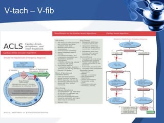 V-tach – V-fib
 