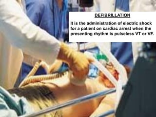 DEFIBRILLATION
It is the administration of electric shock
for a patient on cardiac arrest when the
presenting rhythm is pulseless VT or VF.
 