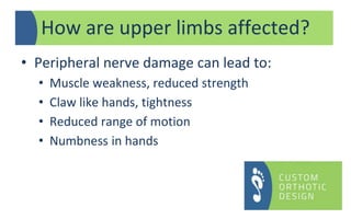 • Peripheral nerve damage can lead to:
• Muscle weakness, reduced strength
• Claw like hands, tightness
• Reduced range of motion
• Numbness in hands
How are upper limbs affected?
 