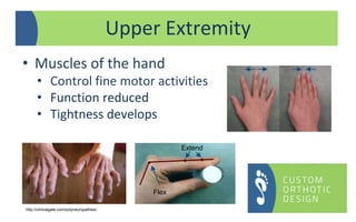 • Muscles of the hand
• Control fine motor activities
• Function reduced
• Tightness develops
Upper Extremity
Extend
Flex
http://clinicalgate.com/polyneuropathies/
 