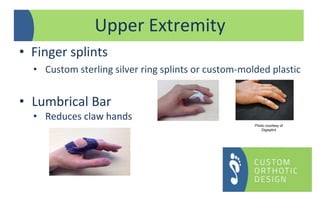 • Finger splints
• Custom sterling silver ring splints or custom-molded plastic
• Lumbrical Bar
• Reduces claw hands
Upper Extremity
Photo courtesy of
Digisplint
 