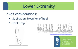 Lower Extremity
• Gait considerations:
• Supination, inversion of heel
www.equusmedical.com/information/michaudreview.htm
• Foot Drop
 
