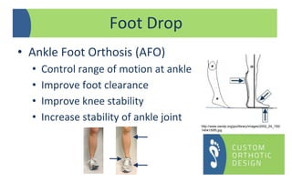 • Ankle Foot Orthosis (AFO)
• Control range of motion at ankle
• Improve foot clearance
• Improve knee stability
• Increase stability of ankle joint
Foot Drop
http://www.oandp.org/jpo/library/images/2002_04_150/
1404150f5.jpg
 