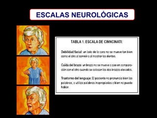 ESCALAS NEUROLÓGICAS

 