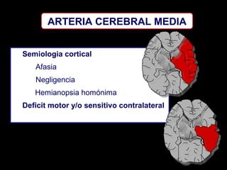ARTERIA CEREBRAL MEDIA
Semiologia cortical
Afasia
Negligencia
Hemianopsia homónima
Deficit motor y/o sensitivo contralateral

 