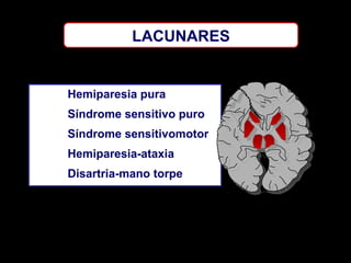 LACUNARES

Hemiparesia pura
Síndrome sensitivo puro
Síndrome sensitivomotor
Hemiparesia-ataxia
Disartria-mano torpe

 