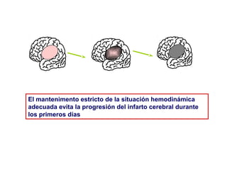 El mantenimento estricto de la situación hemodinámica
adecuada evita la progresión del infarto cerebral durante
los primeros días

 