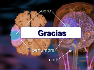 Gracias

 