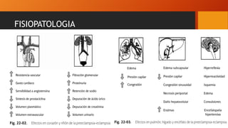 FISIOPATOLOGIA
 