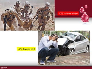 10% trauma militar
5 % trauma civil
 