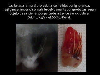Las faltas a la moral profesional cometidas por ignorancia,
negligencia, impericia o mala fe debidamente comprobadas, serán
objeto de sanciones por parte de la Ley de ejercicio de la
Odontología y el Código Penal.
 