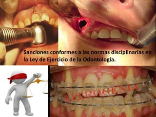 Sanciones conformes a las normas disciplinarias en
la Ley de Ejercicio de la Odontología.
 