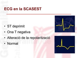 ECG en la SCASEST
• ST deprimit
• Ona T negativa
• Alteració de la repolarització
• Normal
 
