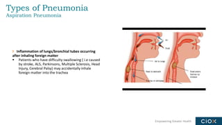 Empowering Greater Health
Types of Pneumonia
Aspiration Pneumonia
Inflammation of lungs/bronchial tubes occurring
after inhaling foreign matter
▪ Patients who have difficulty swallowing ( i.e caused
by stroke, ALS, Parkinsons, Multiple Sclerosis, Head
Injury, Cerebral Palsy) may accidentally inhale
foreign matter into the trachea
 