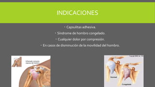 INDICACIONES
Capsulitas adhesiva.
Síndrome de hombro congelado.
Cualquier dolor por compresión.
En casos de disminución de la movilidad del hombro.