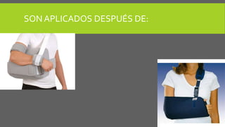 SON APLICADOS DESPUÉS DE: