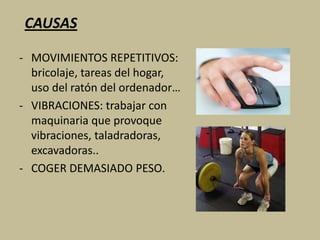 DIAGNÓSTICO	El médico llega a este diagnóstico escuchando las descripción de las quejas del paciente y haciendo una exploración del brazo.	El codo de tenista, por sí mismo, no puede verse en radiografías, pero en algunos casos puede ser necesario obtenerlas para descartar posibles lesiones en el interior de la articulación del codo. 