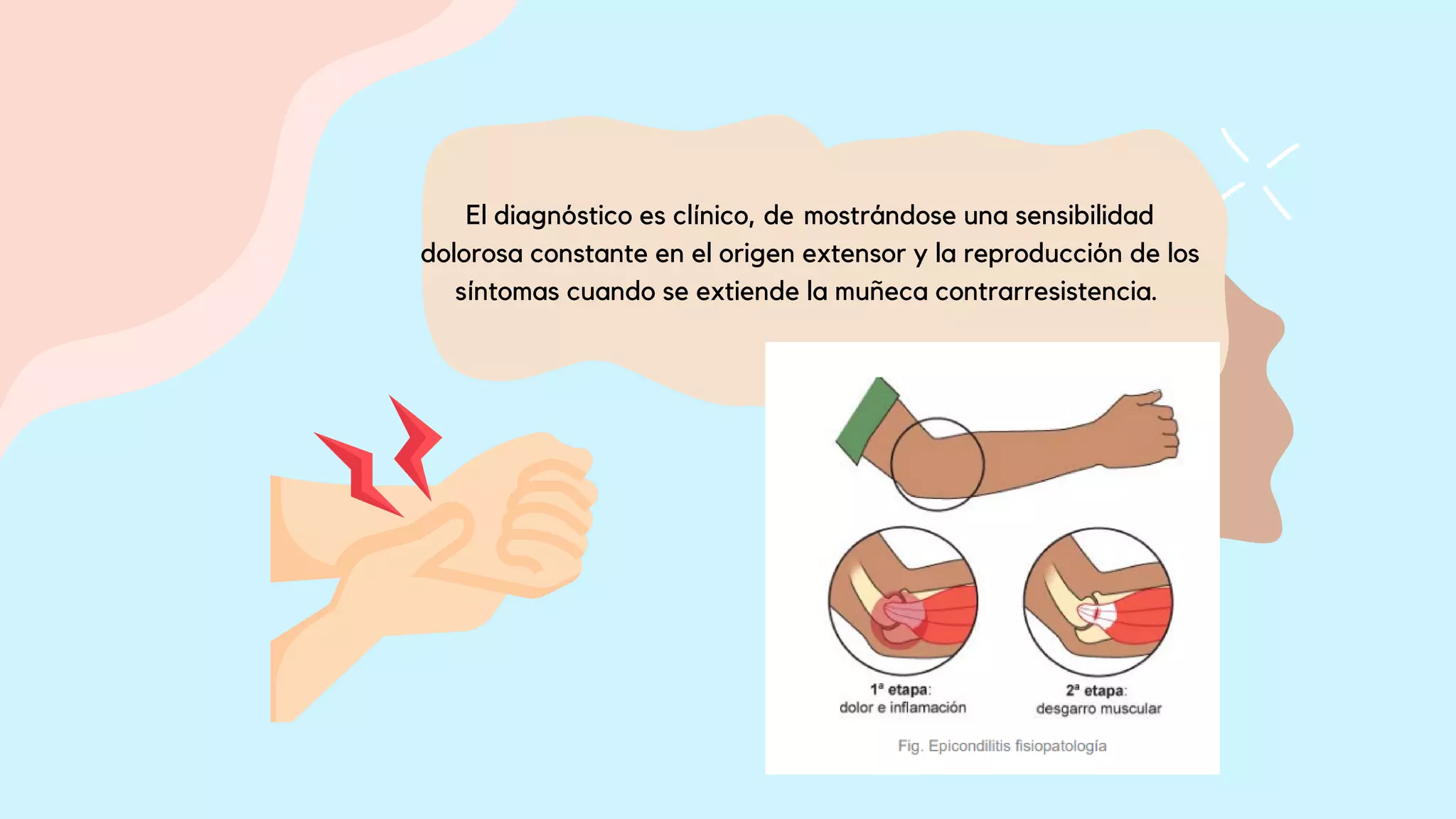 _Codo. (codo de las pequeñas ligas, epicondilitis lateral ...