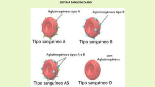 SISTEMA SANGÜÍNEO ABO
 